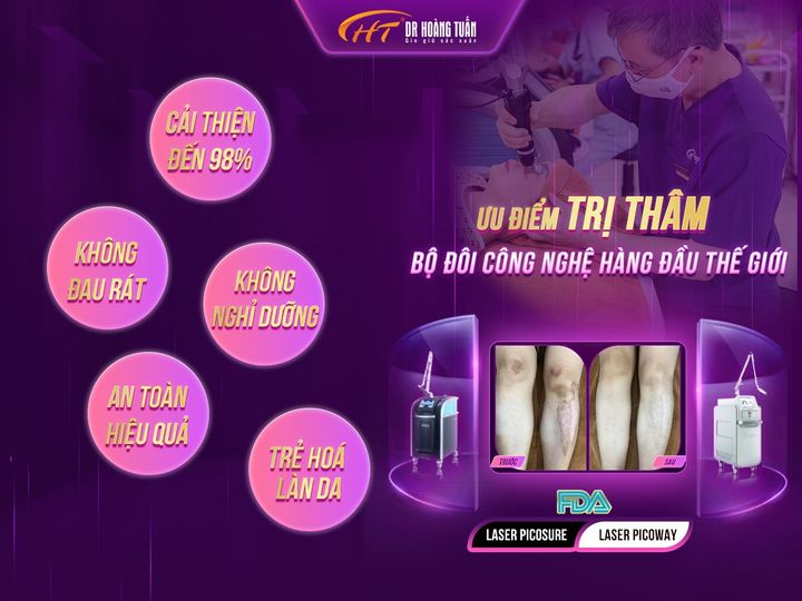 trị thâm bằng laser là gì